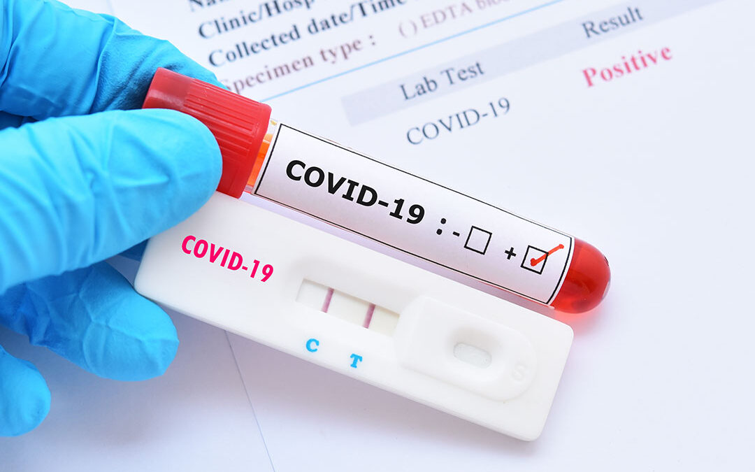 Covid-19: corso diagnostica e corretta lettura dei risultati