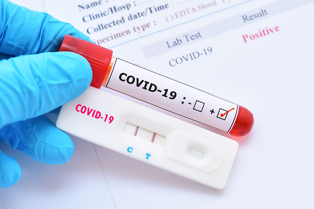 COVID-19: corso diagnostica e corretta lettura ed interpretazione dei risultati